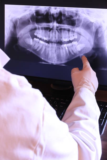 Best Emergency Treatment for Dental Infections or Abscesses in Dexter, MI