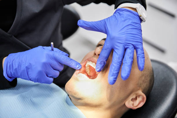 Best Emergency Gum Treatment in Dexter, MI