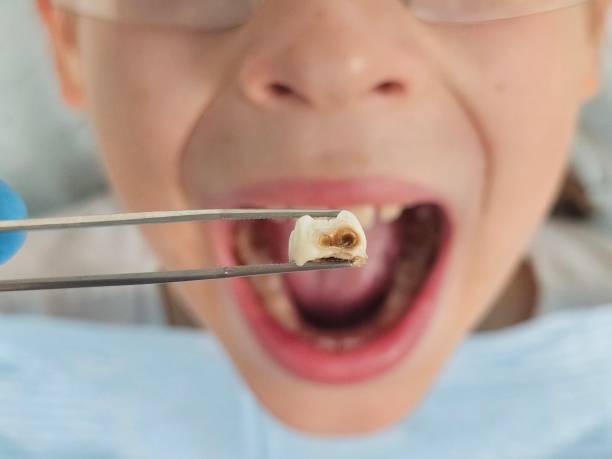 Best Emergency TMJ Treatment in Dexter, MI